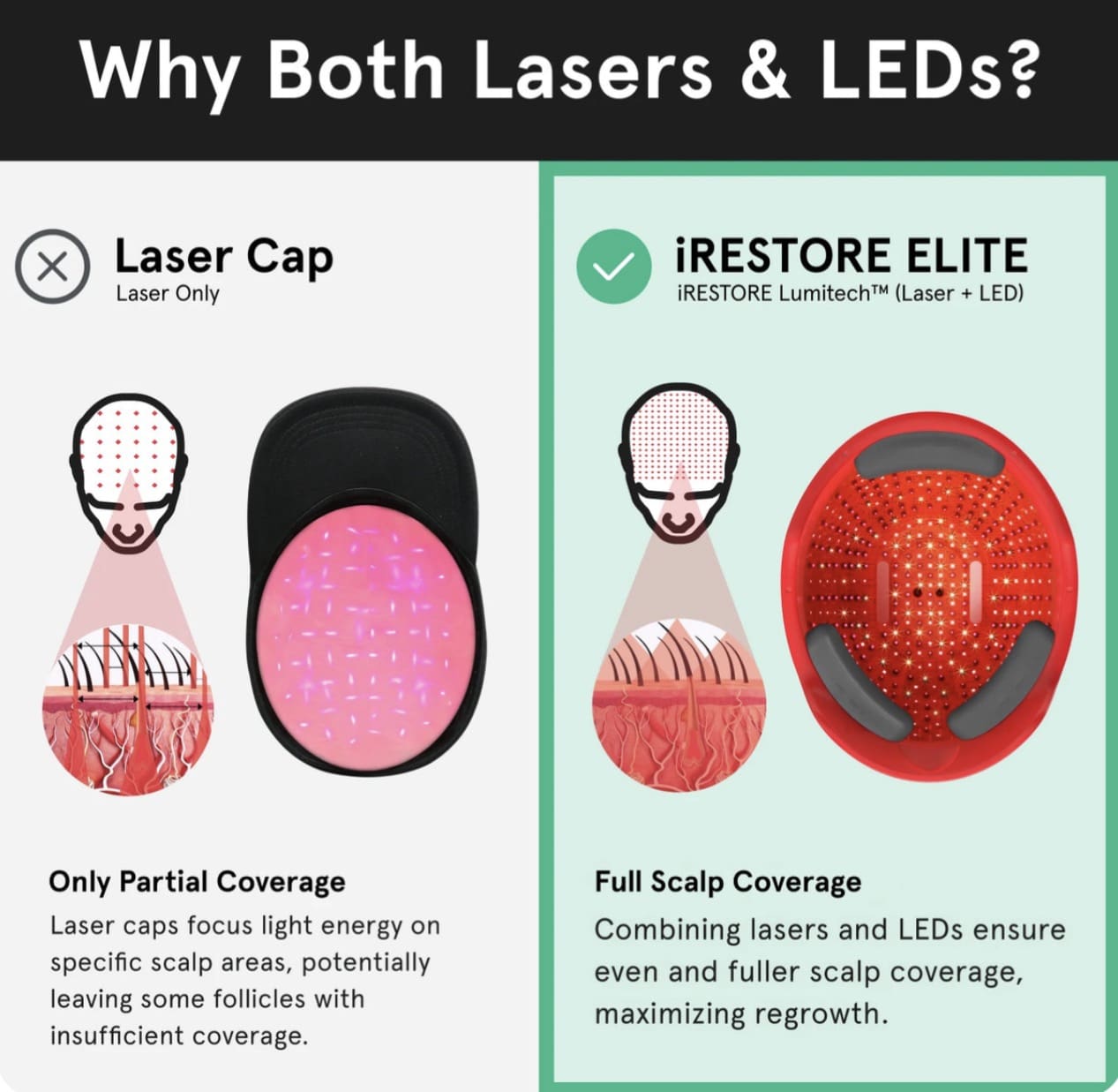 iRESTORE Hair Growth System Elite - Image 2