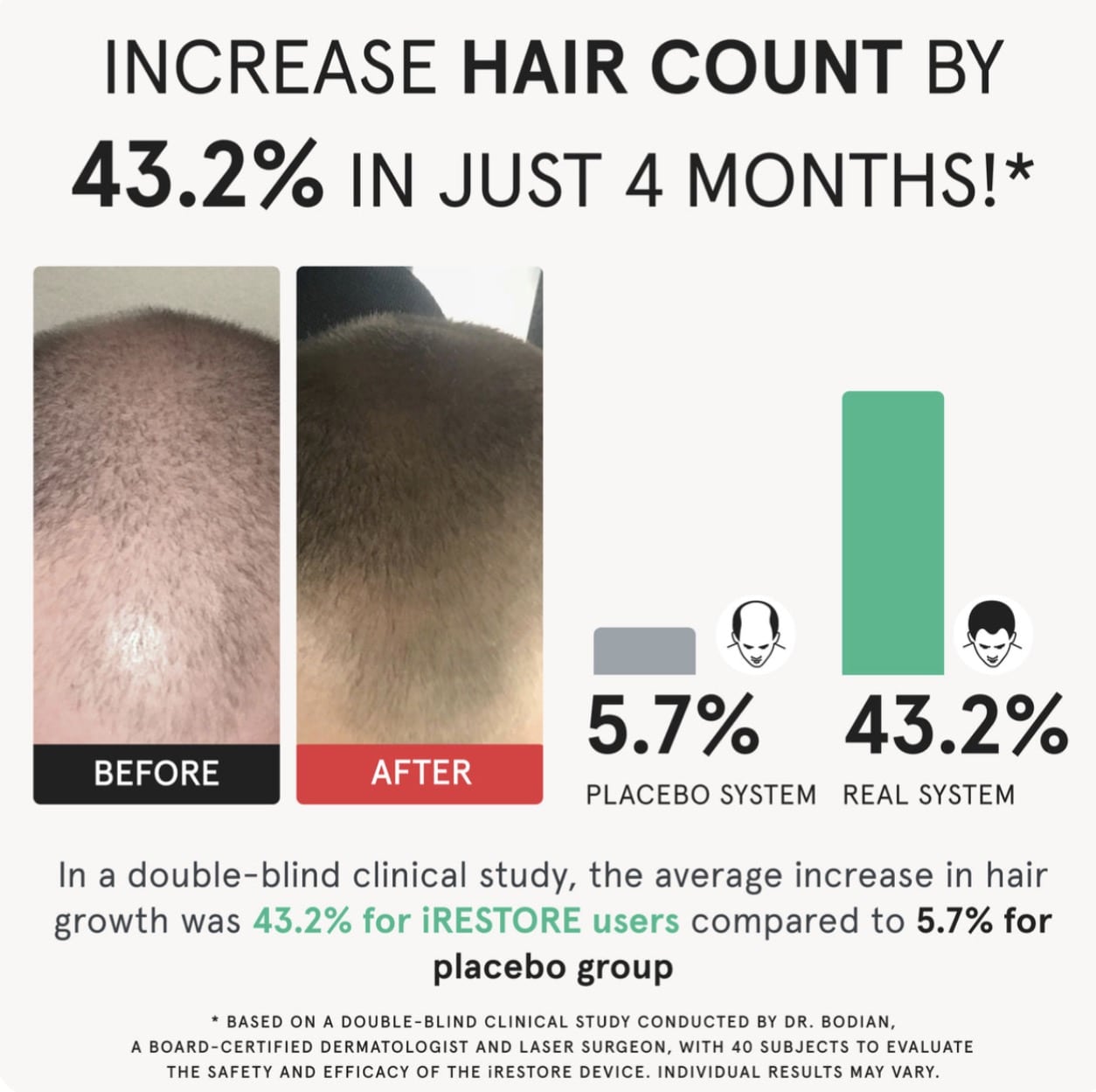 iRESTORE Hair Growth System Elite - Image 4